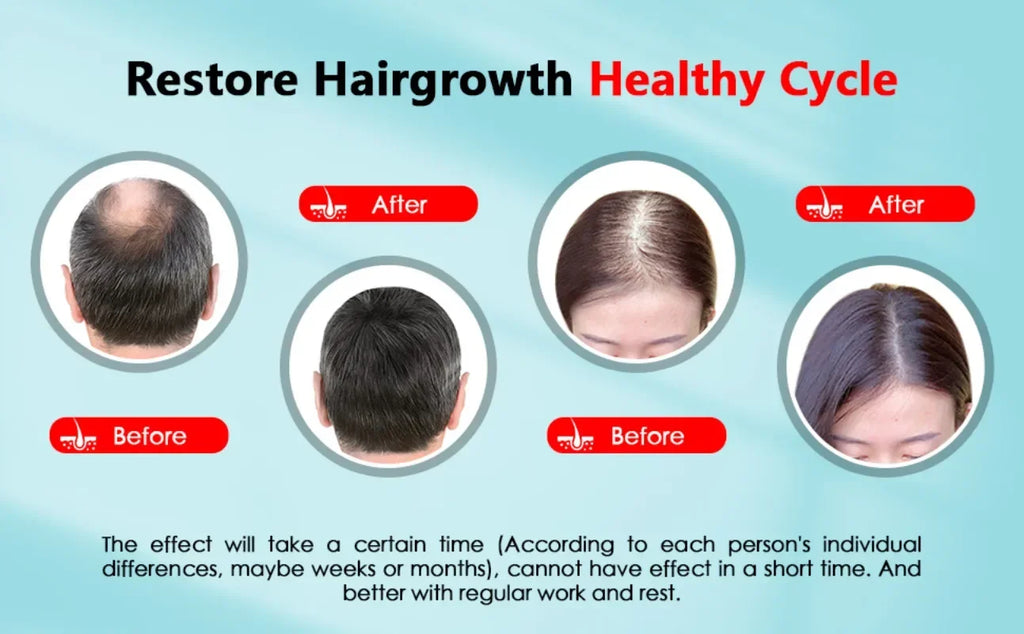 Revolutionary Rechargeable Hair Growth Cap with LED Light Therapy - Combat Hair Loss, Reduce Stress, and Relax Your Scalp!